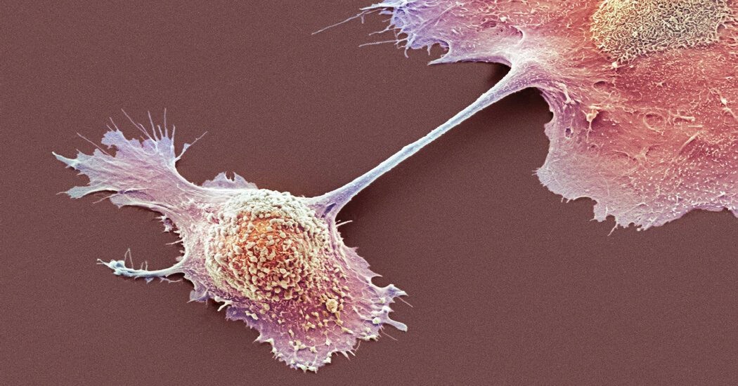 Yeniden Programlanmış Hücreler Bir Kadında Saldırdı ve Ölümcül Kanseri Evcilleştirdi