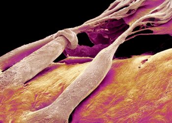 Yeni Tedavi Kalbin ‘Unutulmuş Valfini’ Düzeltmeye Yardımcı Olabilir