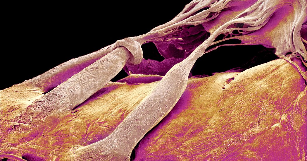 Yeni Tedavi Kalbin ‘Unutulmuş Valfini’ Düzeltmeye Yardımcı Olabilir