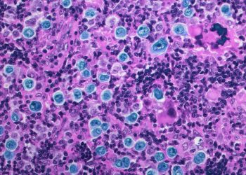 Anahtarı Çevirmek ve Kanserleri Kendi Kendini Yok Etmek