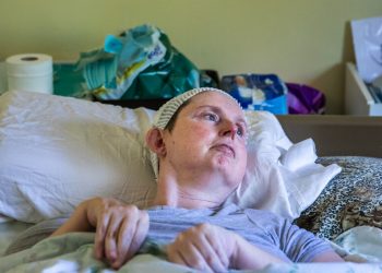 30 Yaşında Bir Felç, Konuşma Yeteneğini Çaldı.  Yapay Zeka, Yıllar Sonra Bu Yeteneğin Geri Kazanılmasına Yardımcı Oluyor.