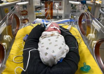 Prematüre Bebekleri Kurtarmanın Basit Bir Yolu