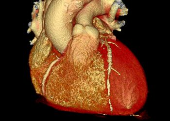Yeni Düzenleme Tedavisi Küçük Bir Araştırmada Tehlikeli Kolesterolü Azaltıyor