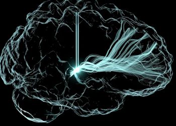 Beyin İmplantları Travmatik Yaralanmalardan Sonra 5 Kişinin İyileşmesine Yardımcı Oldu