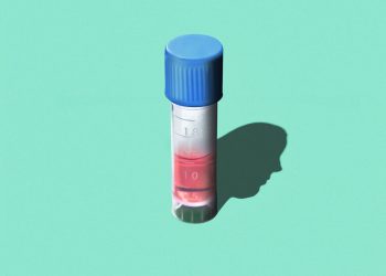 ‘Fetal Kişilik’ Neden Sağa Dönüyor?