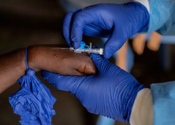 Kaliforniya’da Bildirilen İlk Şiddetli Mpox Formu Vakası