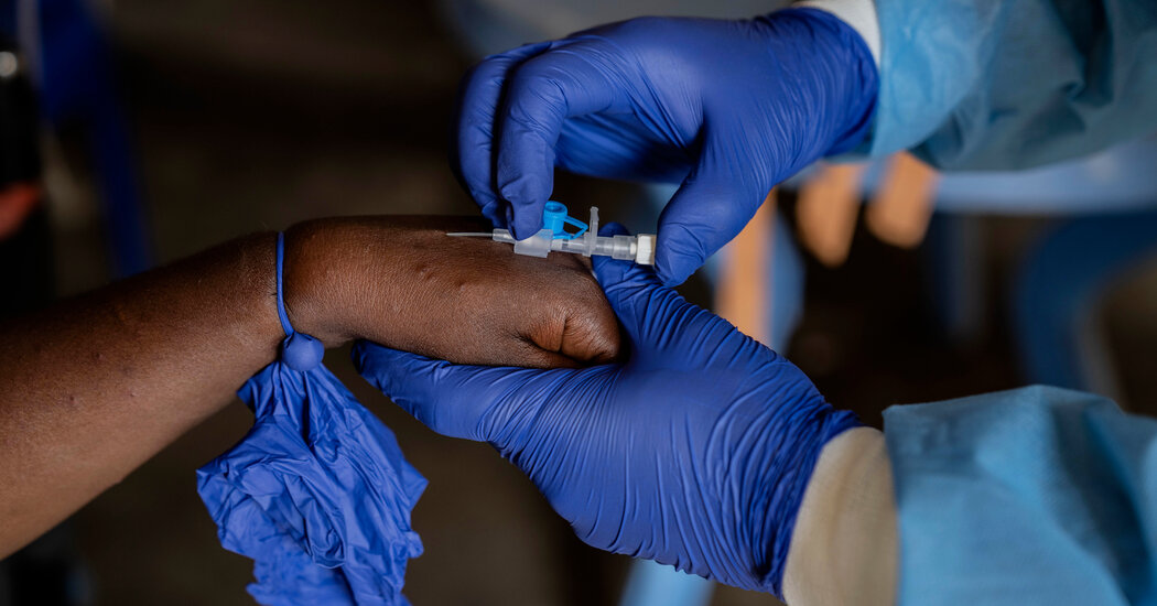 Kaliforniya’da Bildirilen İlk Şiddetli Mpox Formu Vakası