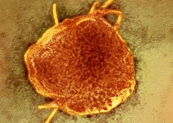 Kuzamık Salgüzi Tekseza Town’a Vuruyor